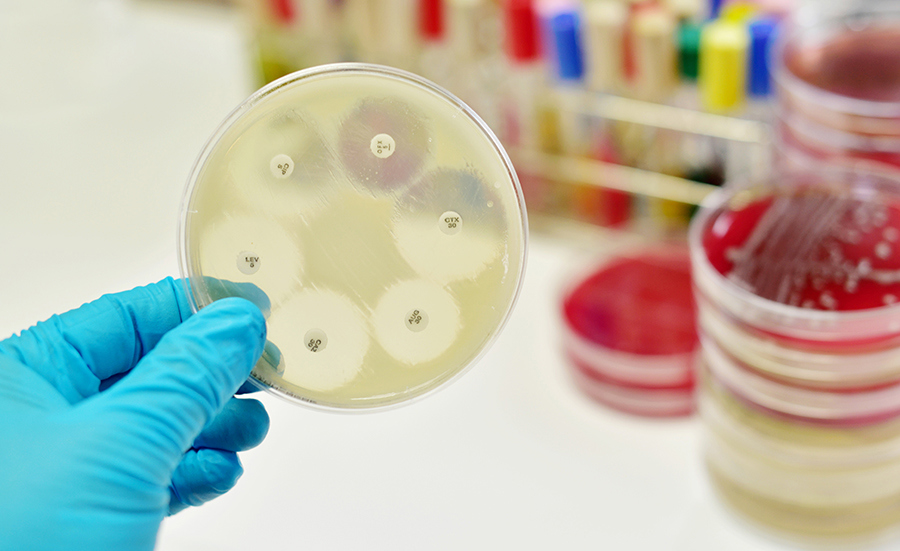 Schützen Umweltqualitätskriterien vor der Ausbreitung von Antibiotikaresistenzen?