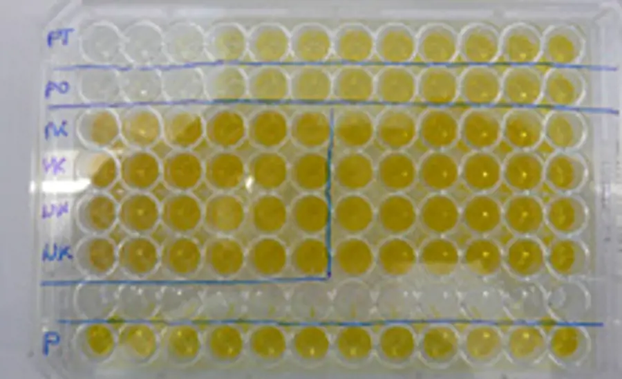 Acetylcholinesterase-Hemmung